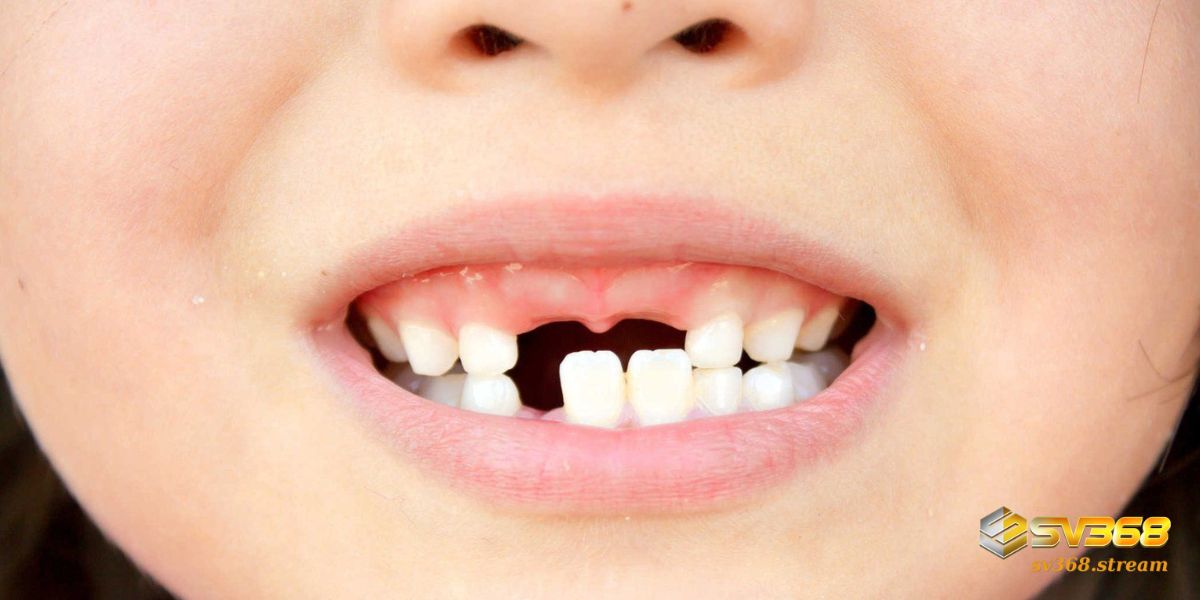 Nằm mơ thấy rụng nhiều răng